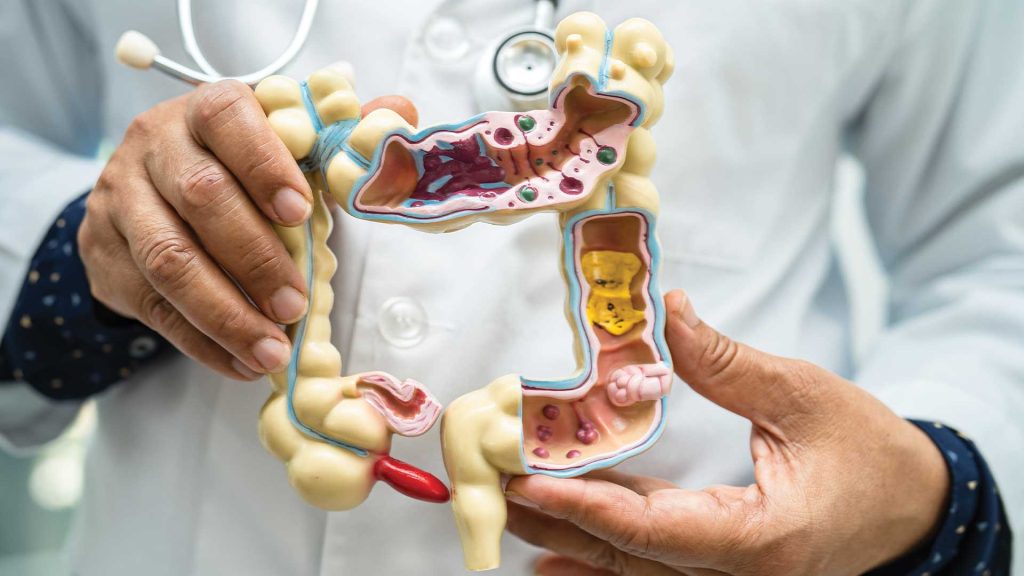 colonoscopy
